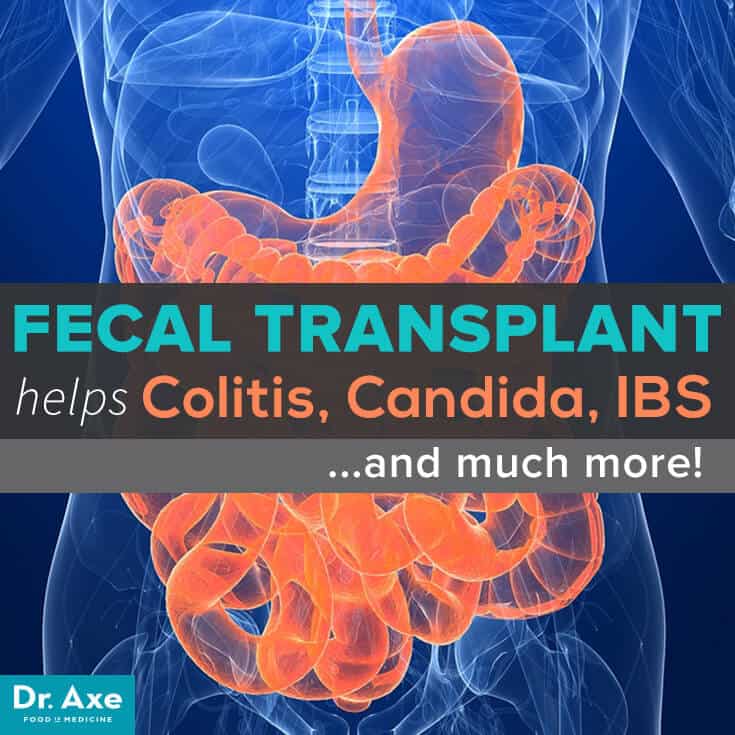 Fecal Transplant helps Colitis, IBS, and More Title